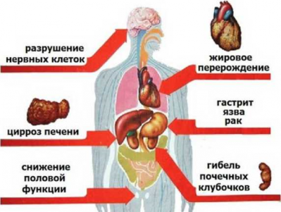 Памятка для подростков и родителей
«Алкоголь - вред для организма человека»